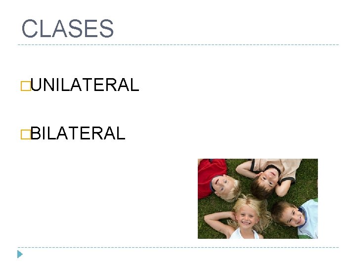 CLASES �UNILATERAL �BILATERAL 