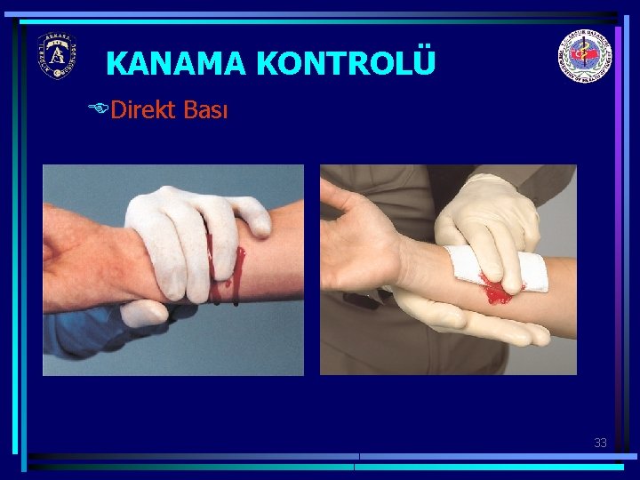 KANAMA KONTROLÜ EDirekt Bası 33 