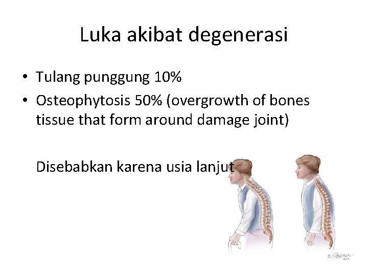 Luka akibat degenerasi • Tulang punggung 10% • Osteophytosis 50% (overgrowth of bones tissue