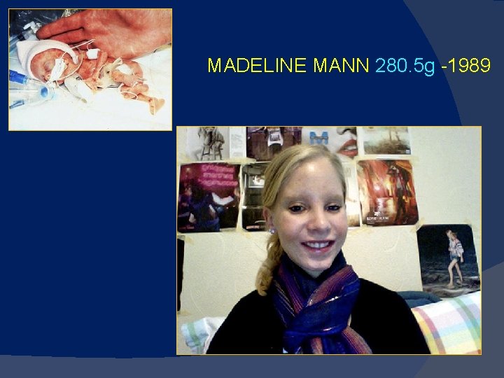 MADELINE MANN 280. 5 g -1989 