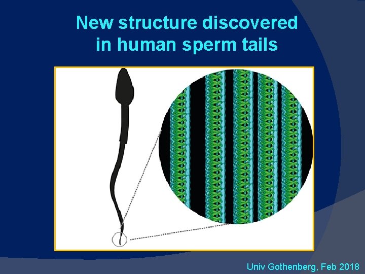 New structure discovered in human sperm tails Univ Gothenberg, Feb 2018 