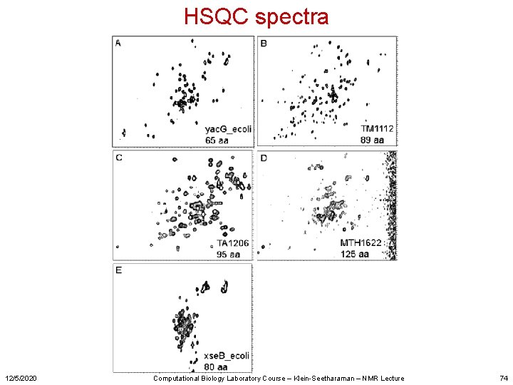 HSQC spectra 12/5/2020 Computational Biology Laboratory Course – Klein-Seetharaman – NMR Lecture 74 