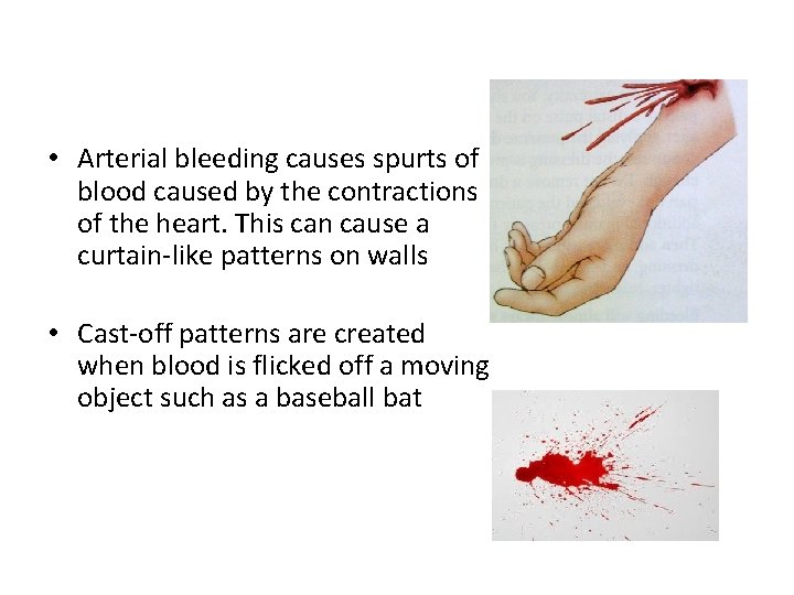  • Arterial bleeding causes spurts of blood caused by the contractions of the