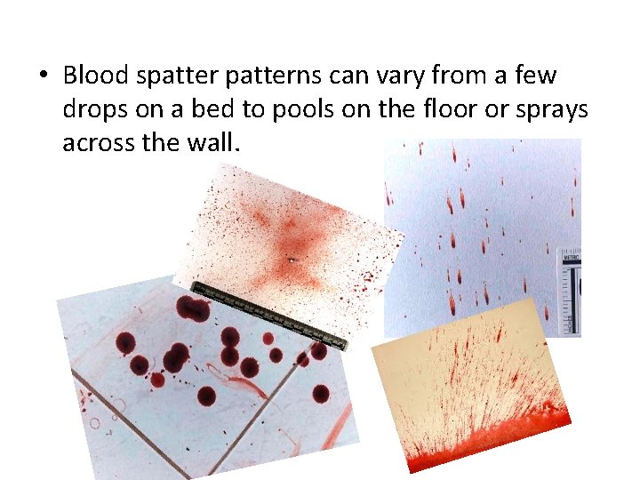  • Blood spatterns can vary from a few drops on a bed to