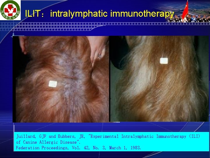  ILIT：intralymphatic immunotherapy Juillard, GJF and Bubbers, JE, "Experimental Intralymphatic Immunotherapy (ILI) of Canine