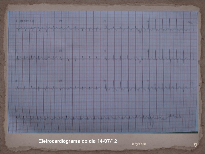 Eletrocardiograma (14/07/12) Eletrocardiograma do dia 14/07/12 12/5/2020 13 