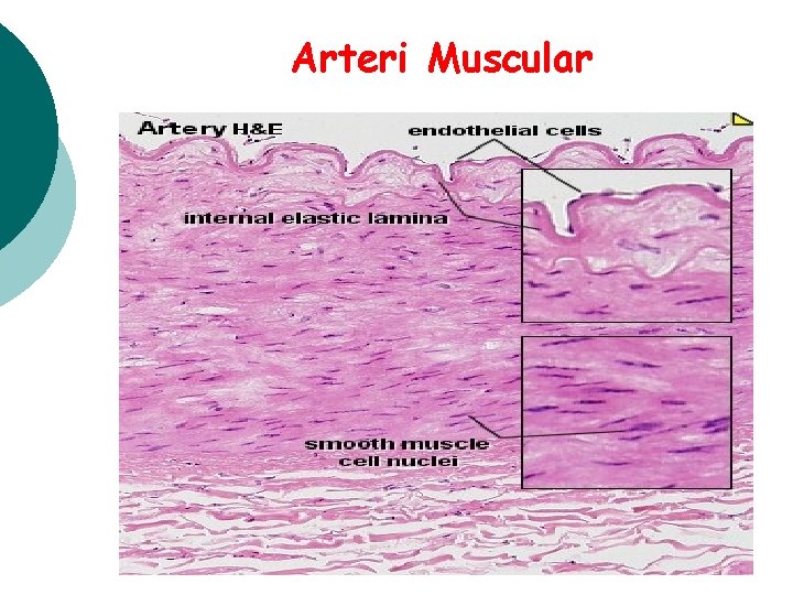 Arteri Muscular 