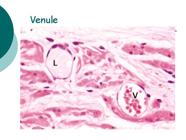 Venule 