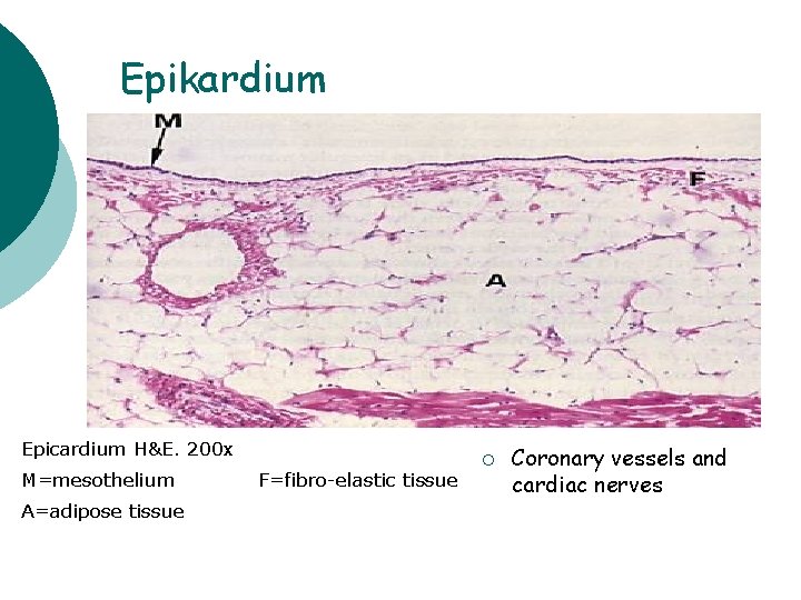  Epikardium Epicardium H&E. 200 x M=mesothelium A=adipose tissue F=fibro-elastic tissue ¡ Coronary vessels