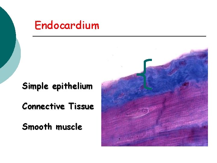 Endocardium Simple epithelium Connective Tissue Smooth muscle 