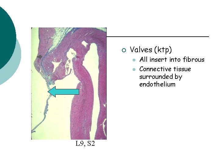 ¡ Valves (ktp) l l L 9, S 2 All insert into fibrous Connective