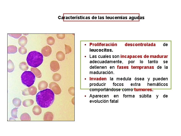 Características de las leucemias agudas • Proliferación descontrolada de leucocitos. • Las cuales son