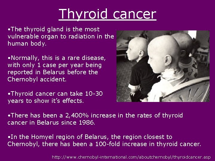 Thyroid cancer • The thyroid gland is the most vulnerable organ to radiation in