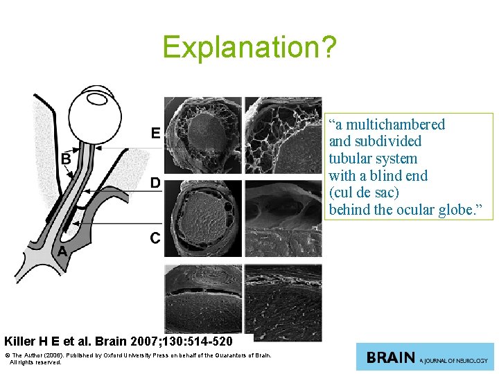 Explanation? “a multichambered and subdivided tubular system with a blind end (cul de sac)