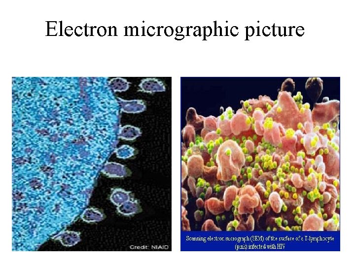 Electron micrographic picture 