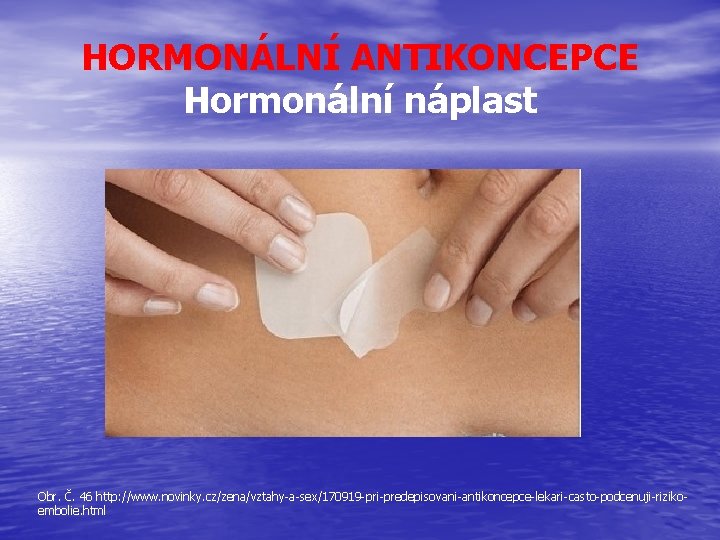 HORMONÁLNÍ ANTIKONCEPCE Hormonální náplast Obr. Č. 46 http: //www. novinky. cz/zena/vztahy-a-sex/170919 -pri-predepisovani-antikoncepce-lekari-casto-podcenuji-rizikoembolie. html 