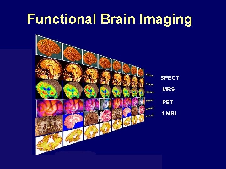 Functional Brain Imaging SPECT MRS PET f MRI 