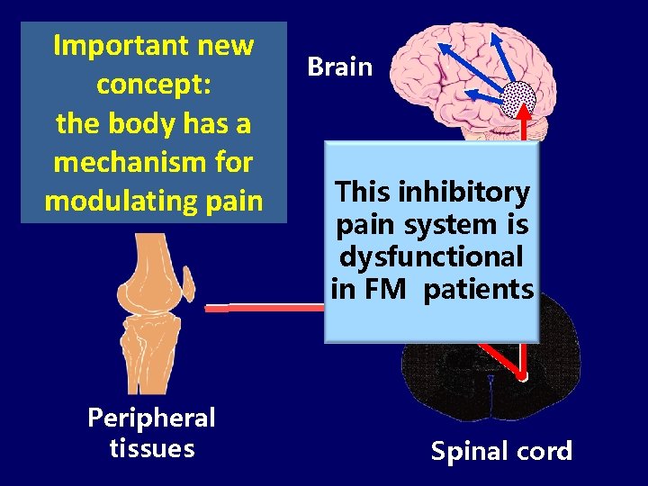 Important new concept: the body has a mechanism for modulating pain Brain Descendi This