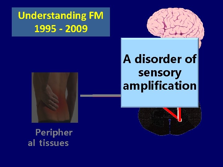 Understanding FM 1995 - 2009 A disorder of sensory amplification Peripher al tissues 