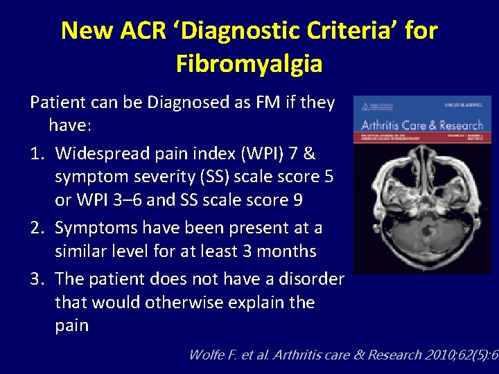 New ACR ‘Diagnostic Criteria’ for Fibromyalgia Patient can be Diagnosed as FM if they