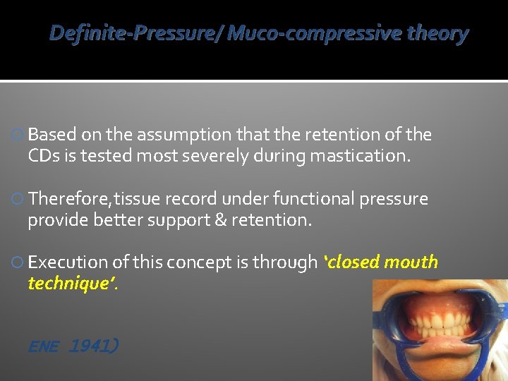 Definite-Pressure/ Muco-compressive theory Based on the assumption that the retention of the CDs is