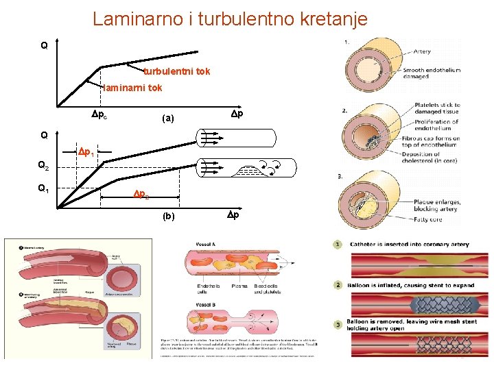 Laminarno i turbulentno kretanje Q turbulentni tok laminarni tok pc (a) p Q p