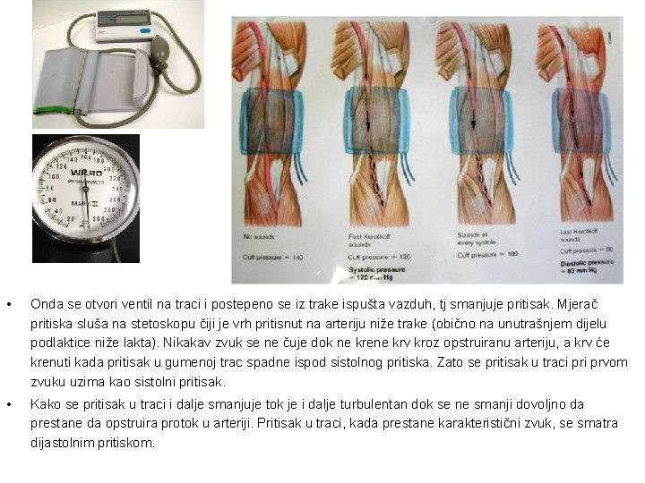  • Onda se otvori ventil na traci i postepeno se iz trake ispušta