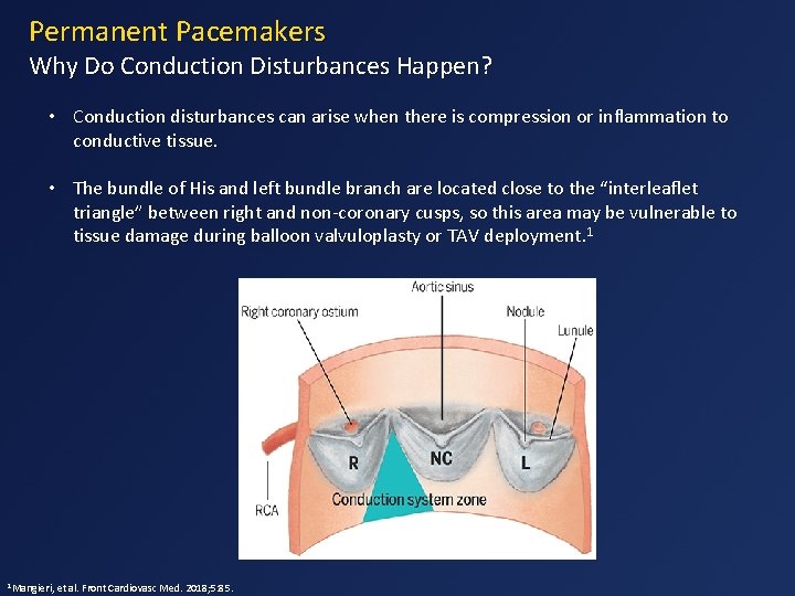 Permanent Pacemakers Why Do Conduction Disturbances Happen? • Conduction disturbances can arise when there