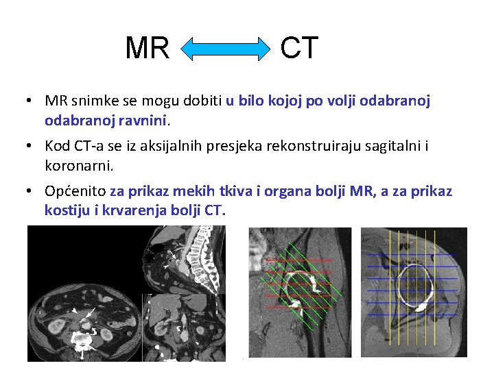 MR CT • MR snimke se mogu dobiti u bilo kojoj po volji odabranoj