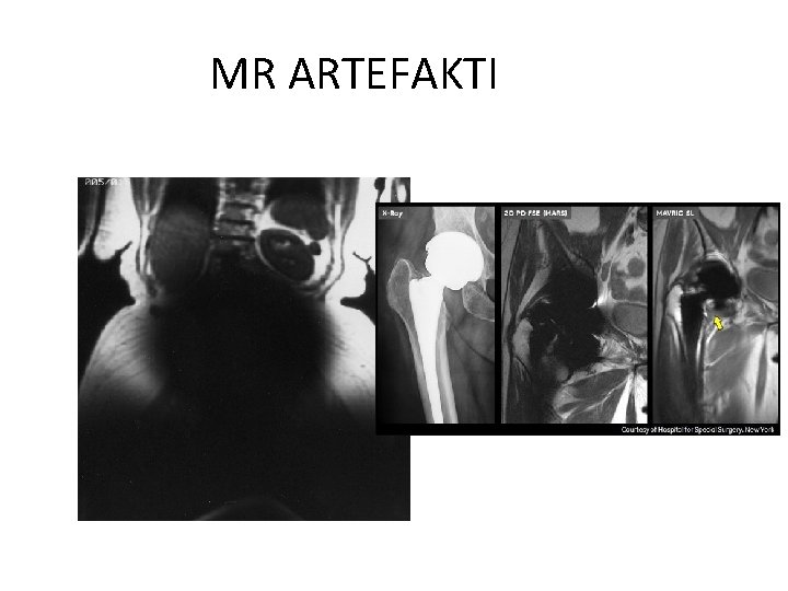 MR ARTEFAKTI 