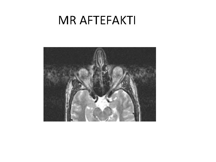 MR AFTEFAKTI 