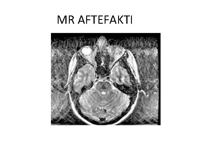 MR AFTEFAKTI 