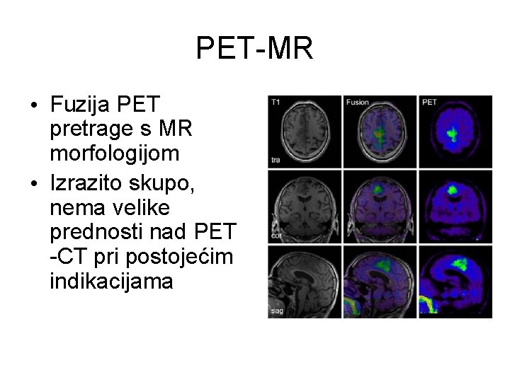 PET-MR • Fuzija PET pretrage s MR morfologijom • Izrazito skupo, nema velike prednosti