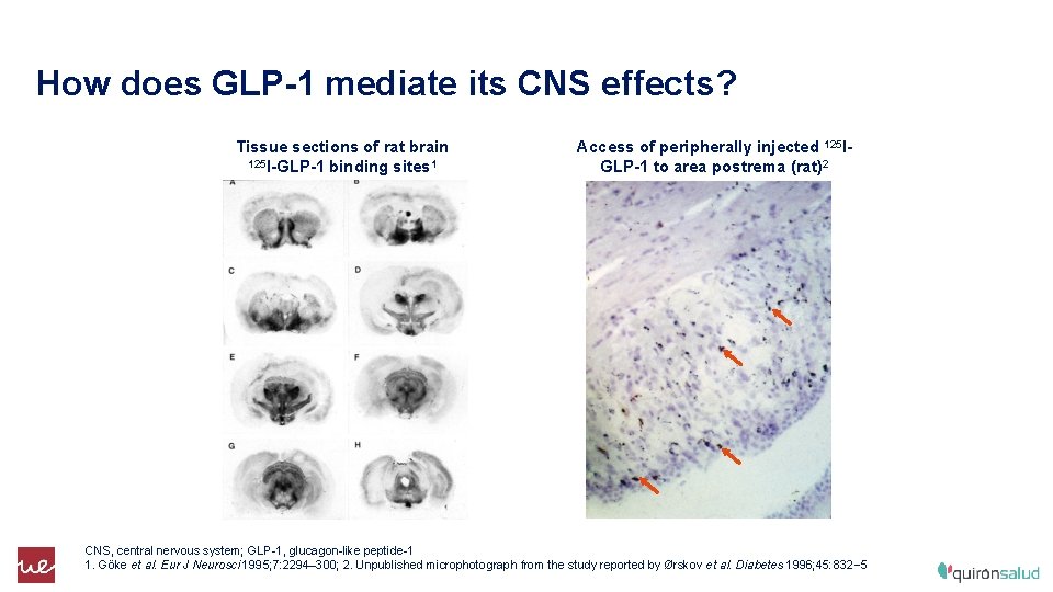 How does GLP-1 mediate its CNS effects? Tissue sections of rat brain 125 I-GLP-1