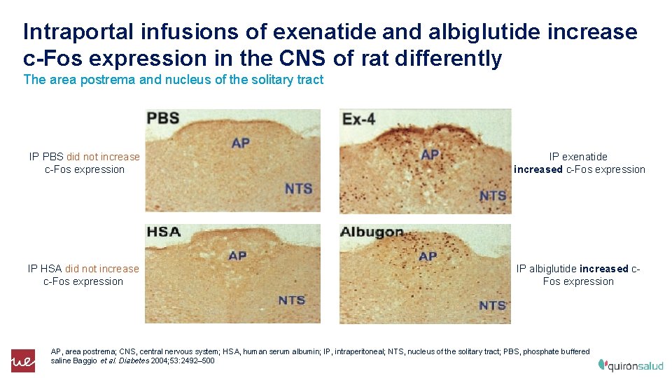 Intraportal infusions of exenatide and albiglutide increase c-Fos expression in the CNS of rat