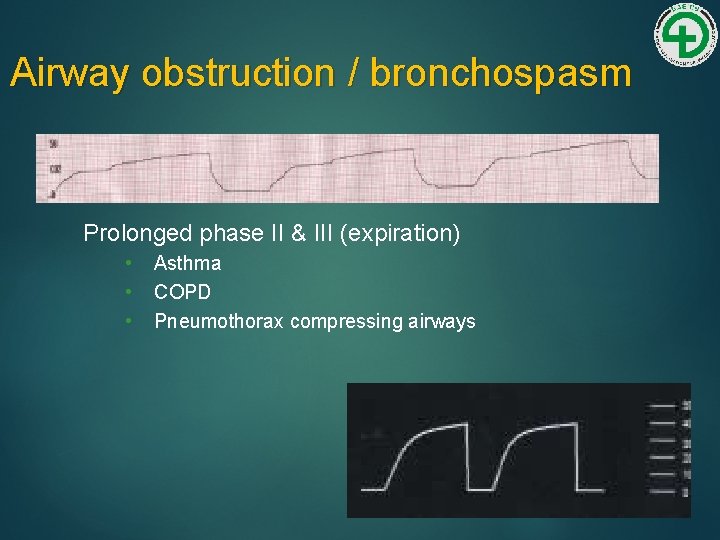 Airway obstruction / bronchospasm Prolonged phase II & III (expiration) • • • Asthma