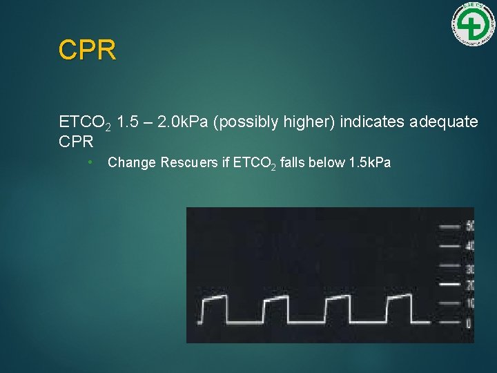 CPR ETCO 2 1. 5 – 2. 0 k. Pa (possibly higher) indicates adequate