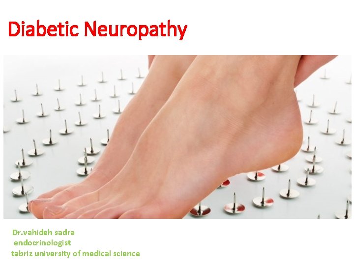 Diabetic Neuropathy Dr. vahideh sadra endocrinologist tabriz university of medical science 