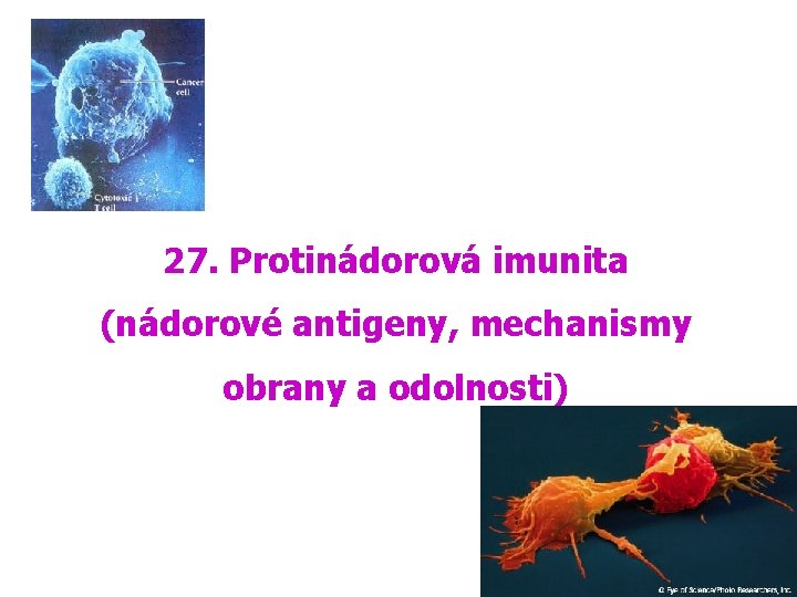 27. Protinádorová imunita (nádorové antigeny, mechanismy obrany a odolnosti) 