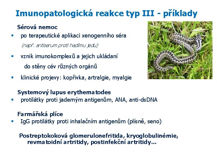  Imunopatologická reakce typ III - příklady Sérová nemoc po terapeutické aplikaci xenogenního séra