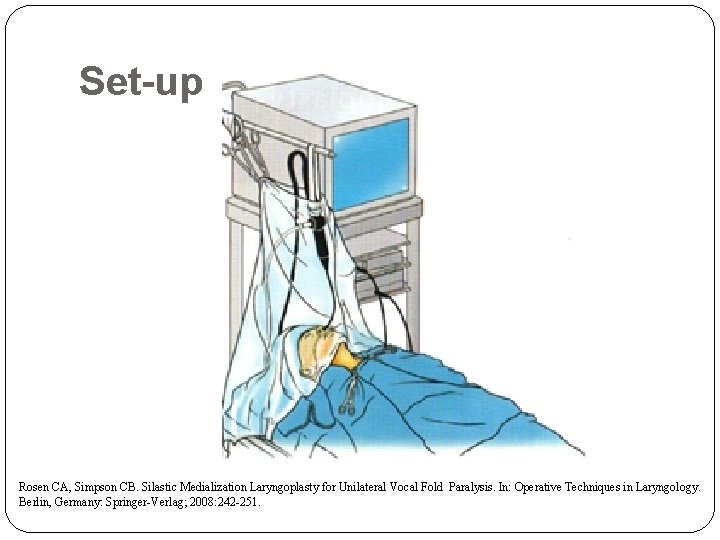 Set-up Rosen CA, Simpson CB. Silastic Medialization Laryngoplasty for Unilateral Vocal Fold Paralysis. In: