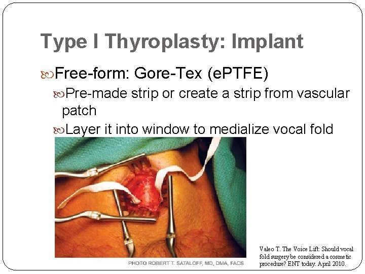 Type I Thyroplasty: Implant Free-form: Gore-Tex (e. PTFE) Pre-made strip or create a strip