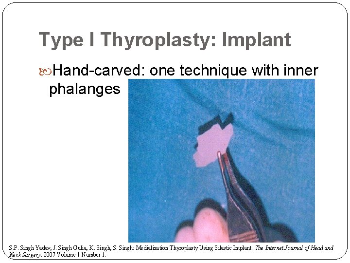 Type I Thyroplasty: Implant Hand-carved: one technique with inner phalanges S. P. Singh Yadav,