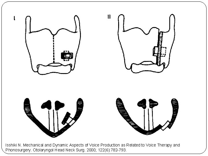 Isshiki N. Mechanical and Dynamic Aspects of Voice Production as Related to Voice Therapy