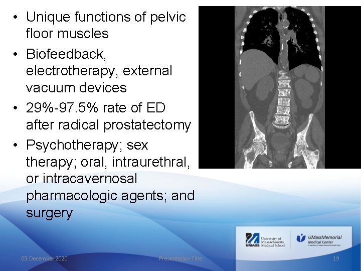  • Unique functions of pelvic floor muscles • Biofeedback, electrotherapy, external vacuum devices