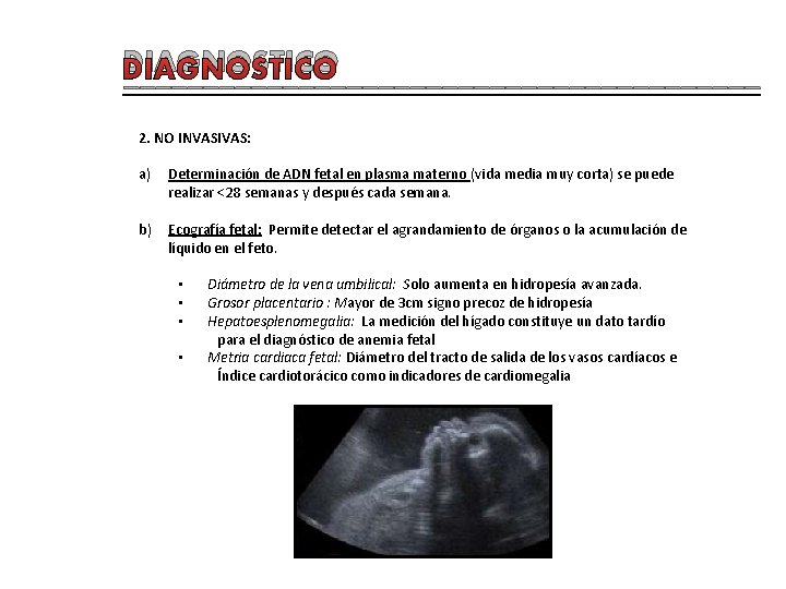 DIAGNOSTICO ____________________ 2. NO INVASIVAS: a) Determinación de ADN fetal en plasma materno (vida
