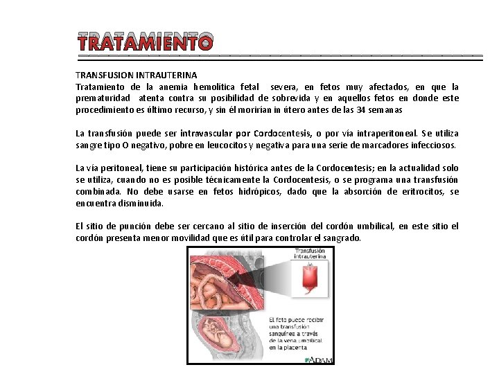 TRATAMIENTO ____________________ TRANSFUSION INTRAUTERINA Tratamiento de la anemia hemolítica fetal severa, en fetos muy