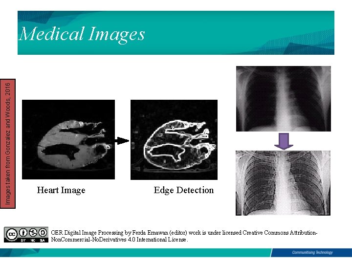 Images taken from Gonzalez and Woods, 2016 Medical Images Heart Image Edge Detection OER