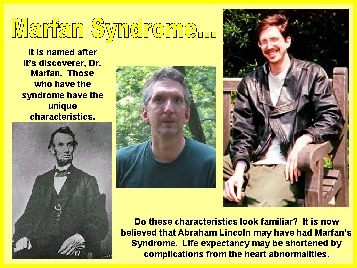 It is named after it’s discoverer, Dr. Marfan. Those who have the syndrome have