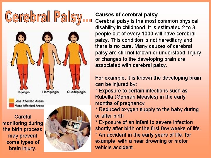 Causes of cerebral palsy Cerebral palsy is the most common physical disability in childhood.